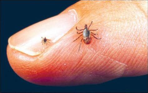 Tick Tip Preventing Lyme Disease After A Bite Marthas Vineyard Ma