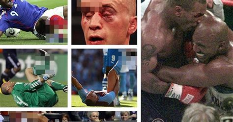 Raquel Daily Blog Photos 10 Of The Most Gruesome Sports