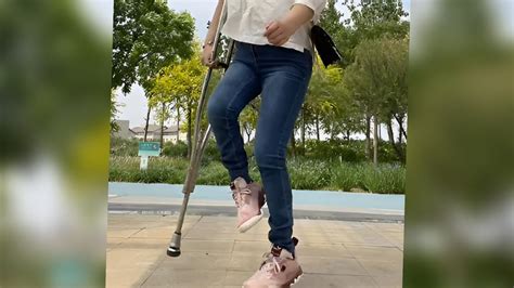 Beautiful Has Very Short Leg And Walks With Crutches33😍 ️crutches