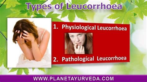Leucorrhoea Whitish Discharge Types Causes Symptoms Diet Home