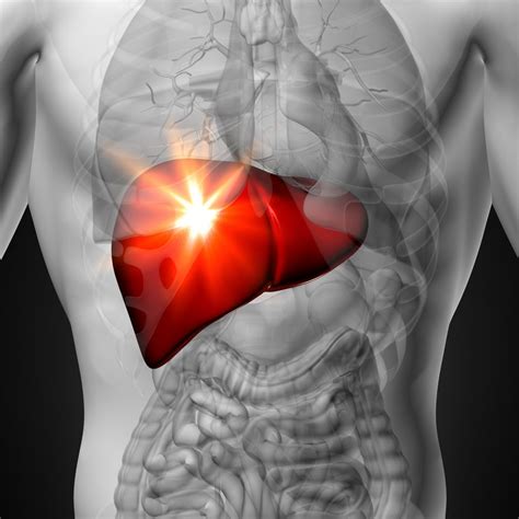 What You Should Know About Acute Liver Failure