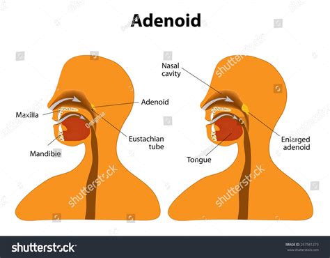 Adenoid Side View Show Position Adenoids Stock Vector Royalty Free
