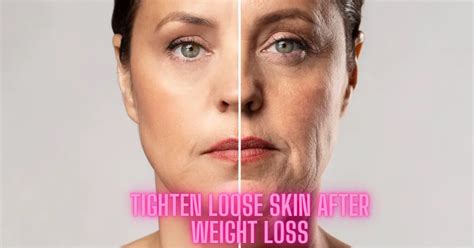 Tighten Loose Skin After Weight Loss Naturally