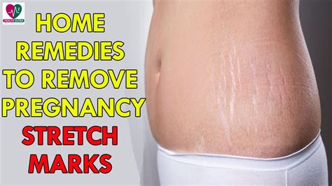 Home Remedies To Remove Pregnancy Stretch Marks Health Sutra Youtube