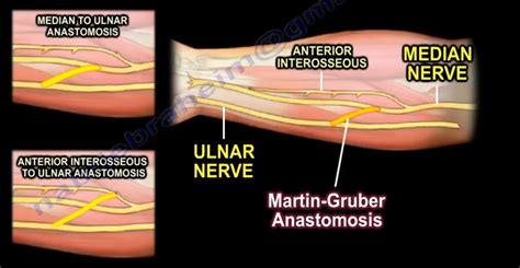 Dr Nabil Ebraheims Blogspot Martin Gruber Anastomosis