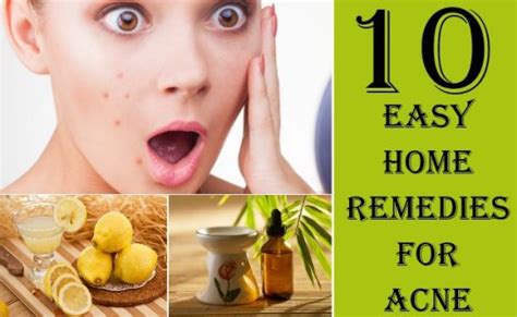 10 Home Remedies To Get Rid Of Pimples