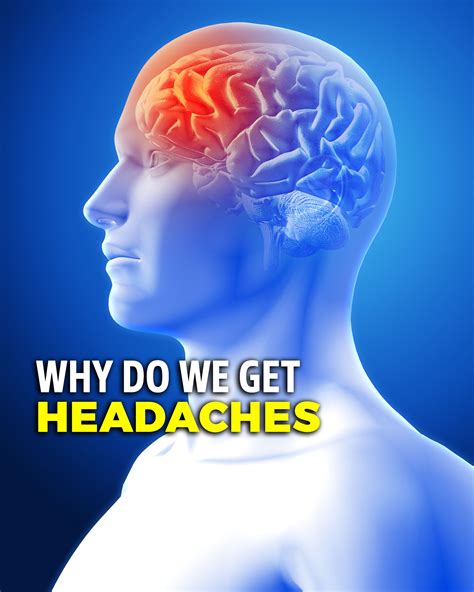 Why Do We Get Headaches Why Do We Get Headaches What Causes Them And How It Happens By