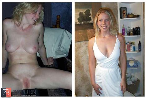 Before And After Photos Elite Dentures My XXX Hot Girl
