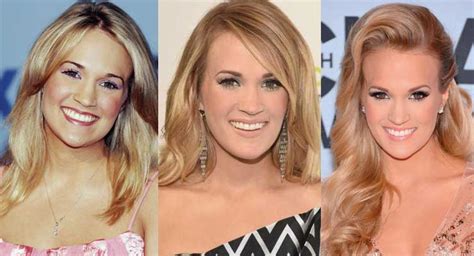 Carrie Underwood Plastic Surgery Before And After Pictures 2024