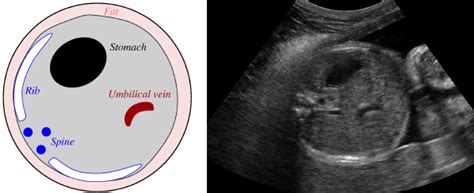 Abdominal Image Acquisition Protocol In Fetal Ultrasound Download