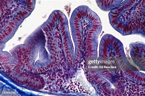 Intestinal Epithelium Photos And Premium High Res Pictures Getty Images