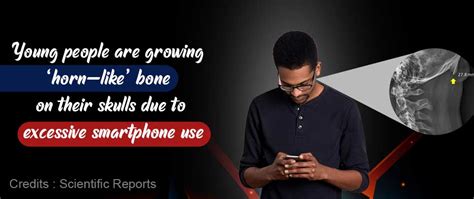 Excessive Smartphone Use Is Causing Young People To Grow Horns