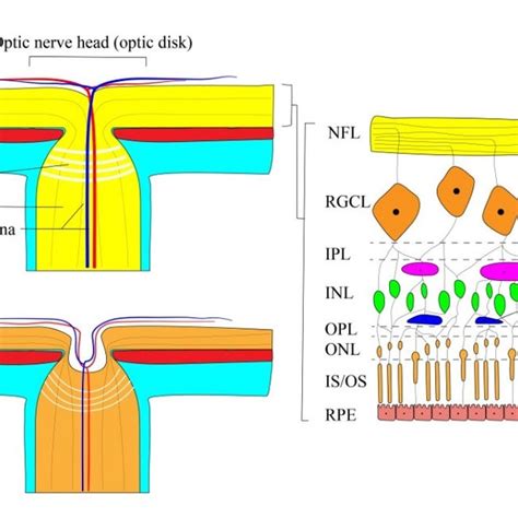 Physiological And Pathologic Structure Of Optic Nerve Head Region Nfl