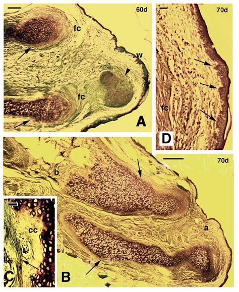 Longitudinal Sections Of Regenerating Limbs Treated With Fgf1 At 60