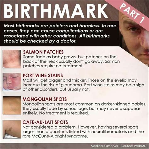 A Poster With Instructions On How To Use Birth Marks