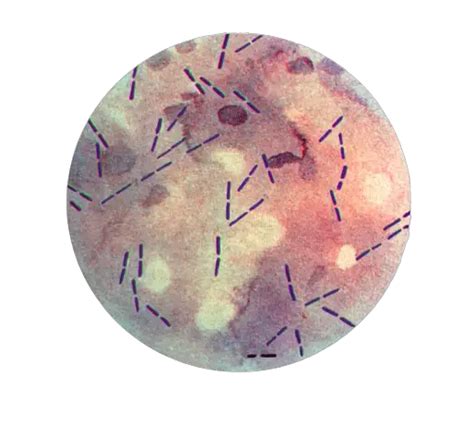 Clostridium Perfringens Properties Diseases Diagnosis Microbe Online