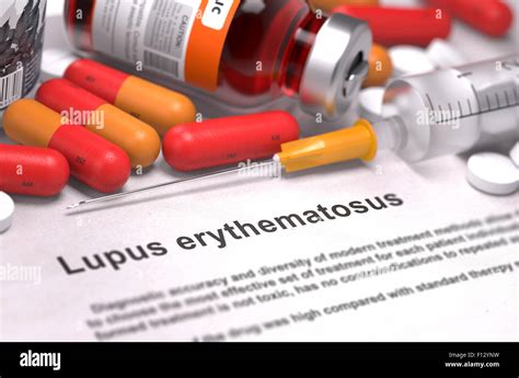 Lupus érythémateux Discoïde Banque De Photographies Et Dimages à Haute