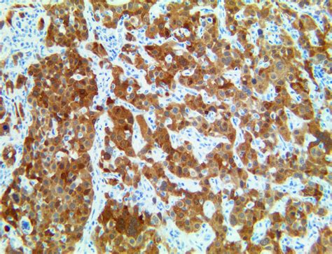 P16 Antibody Rbt P16 Bio Sb