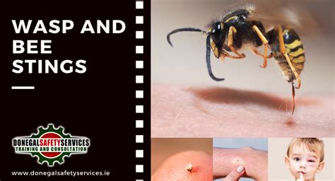 Bee And Wasp Stings Donegal Safety Services Ltd Dss