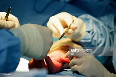 Carpal Tunnel Surgery Photos And Premium High Res Pictures Getty Images
