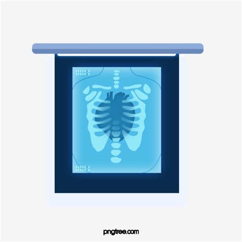 Chest X Ray Hd Transparent Medical X Ray Chest Examination X Ray