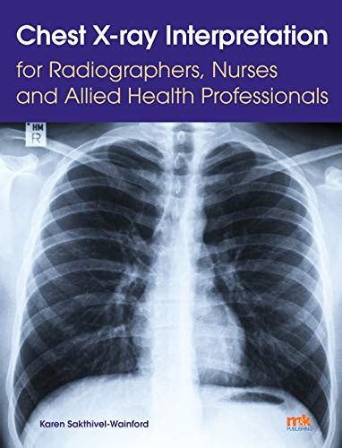 Chest X Ray Interpretation For Radiographers Nurses And Allied Health