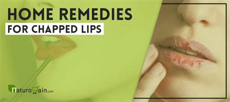 9 Home Remedies For Chapped Lips Best Lip Care Tips That Work