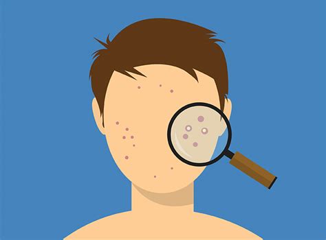 Walk In Dermatology Top 7 Most Common Medical Skin Conditions