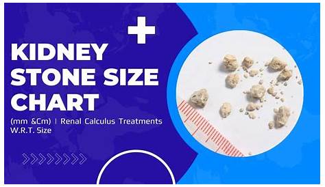 Kidney Stone Size Chart (mm &Cm) | Renal Calculus Treatments W.R.T
