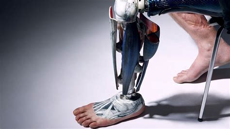 Prosthetics Meet The Man With 13 Legs Bbc Future