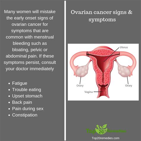 Even then, the signs are usually adding to the complexity is the fact that there is no reliable screening modality for ovarian cancer. Good diet may aid ovarian cancer survival - Top 20 ...