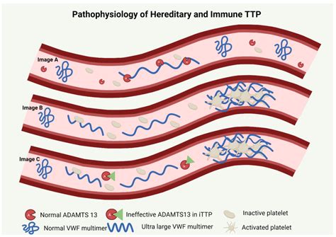 Genes | Free Full-Text | Hereditary Thrombotic Thrombocytopenic Purpura