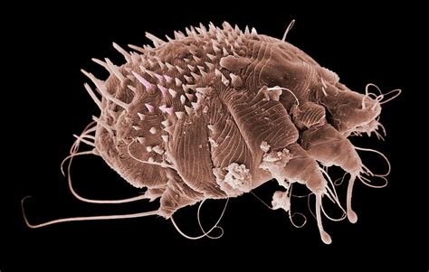 Scabies Mite Photograph By Natural History Museum Londonscience Photo