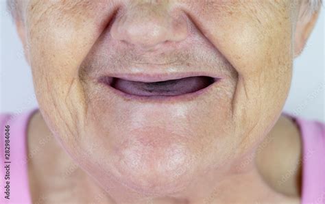 toothless mouth an elderly woman with no teeth old granny with her mouth open stock 写真