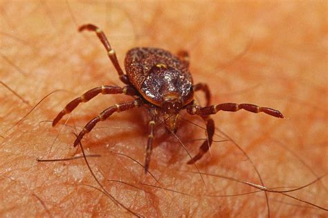 Meat Allergy Caused By Tick Bites Is Becoming More Common Nearly