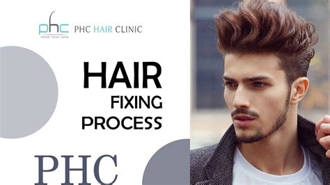 Hair Fixing Process Planetofhaircloning Com