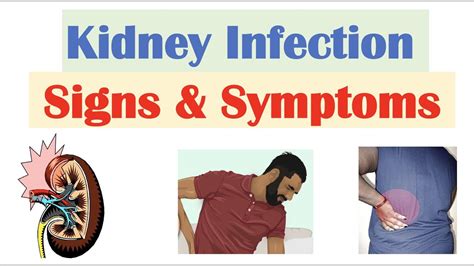 Kidney Infection Pyelonephritis Signs And Symptoms And Why They Occur