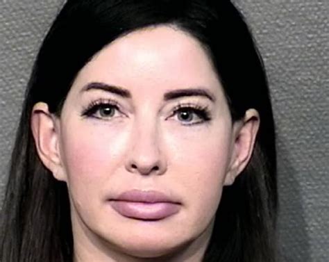 Houston Area Nurse Arrested For Injecting Fillers Without A License