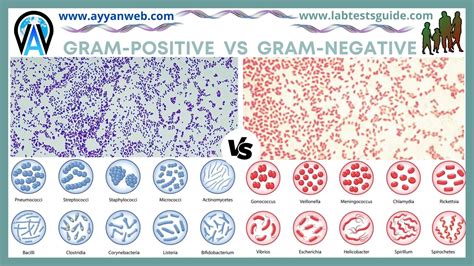 Difference Between Gram Positive And Gram Negative Bacteria Lab Tests Guide