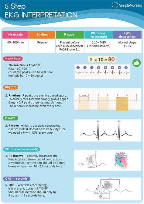 Step EKG Interpretation Step EKG INTERPRETATION Heart Rate Rhythm P Wave PR Interva In