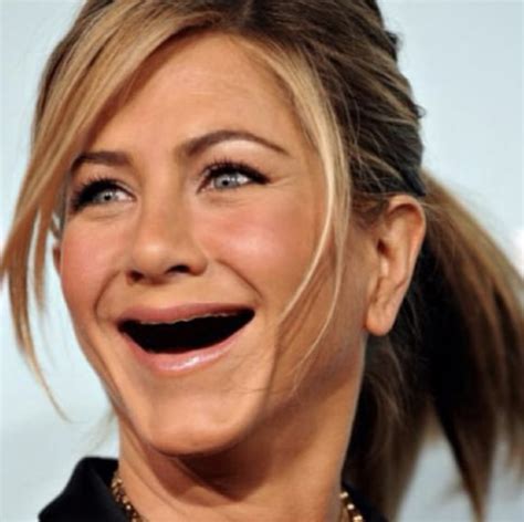 the internet is full of pictures of celebrities without teeth for some reason and it s