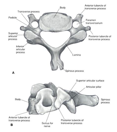 Vertebral compression fractures (vcfs) occur when the bony block or vertebral body in the spine collapses, which can lead to severe pain, deformity and loss of height. C1-C7 (cervical vertebrae). Causes, symptoms, treatment C1 ...