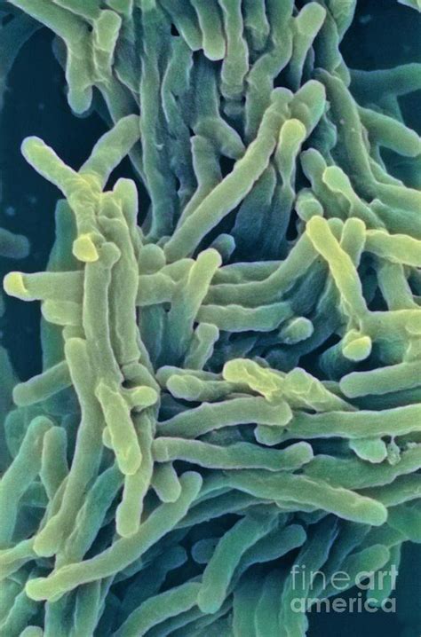 Tuberculosis Bacteria Photograph By A Dowsett National Infection