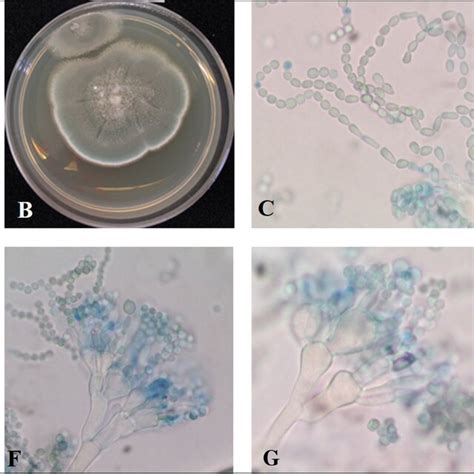 Colonial Characteristics And Microscopic Morphology Of Ant13 Isolate