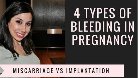Heavy Implantation Bleeding Twins Captions Domestic