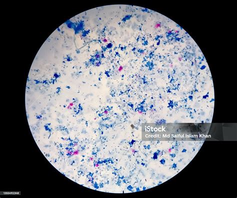 Sputum Smear Afb Stain Microscopic Close View Macrobacterium