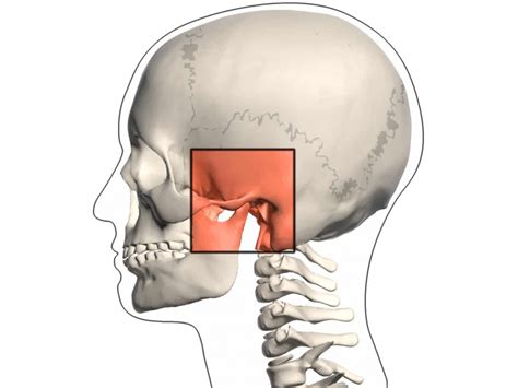 Tmj Disorder In Worcestershire West Midlands Roy Morris Dental