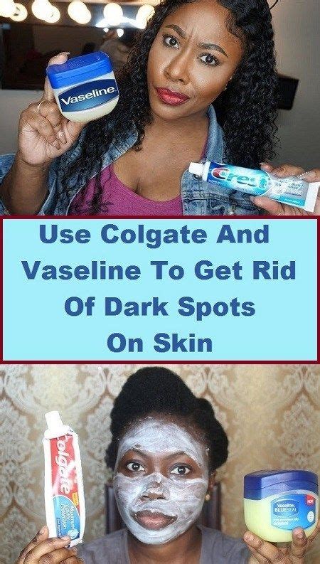Use Colgate And Vaseline To Get Rid Of Dark Spots On The Face