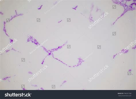 Bacteria On Slide Under Microscope Constitute Stock Photo 796201768