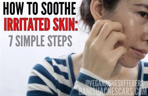 How To Soothe Irritated Skin 7 Simple Steps Skin Irritation Remedies